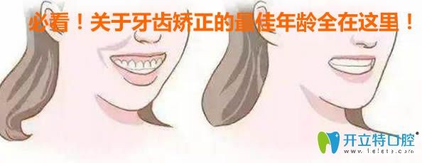 内幕！如果错过了牙齿矫正的较佳年龄，会让你后悔一辈子