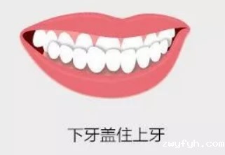 我孩子6岁牙齿是地包天 矫正价格要多少钱/年龄是几岁
