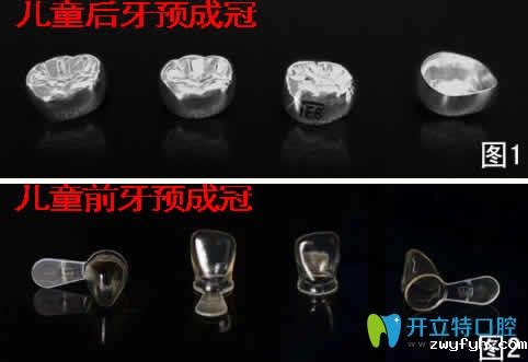 儿童预成冠对牙齿有没有危害及戴预成冠后注意事项的详解