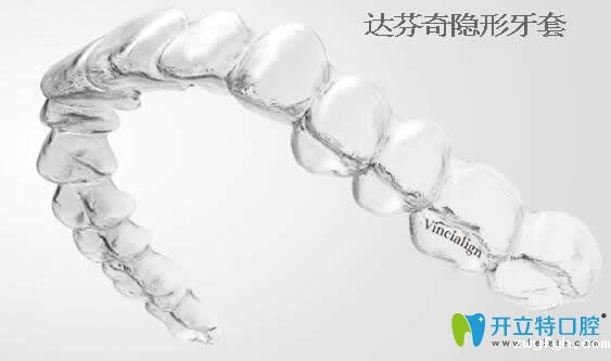 知否:国产达芬奇隐形牙套多少钱及矫正效果怎么样