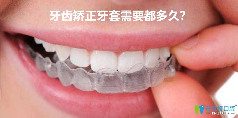 牙套要带多久？牙齿矫正选择传统的牙套好还是隐形的好？