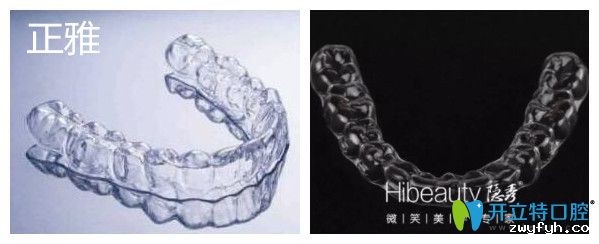 探访:国产隐形牙齿矫正器中隐秀和正雅隐形牙套的区别