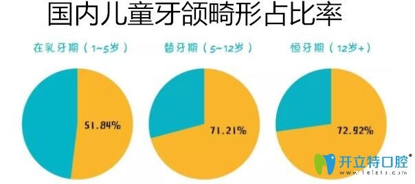  5种常见的牙颌畸形图片和治疗方法,值得收藏哦！