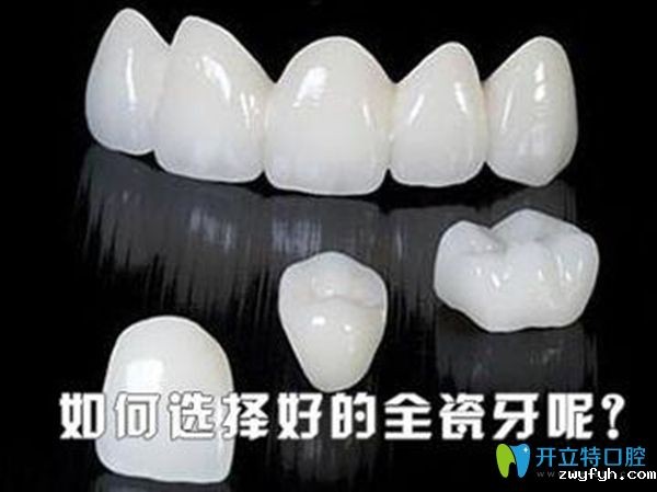 2025全瓷牙品牌排行榜及价格表-含威兰德|爱尔创|泽康全瓷牙