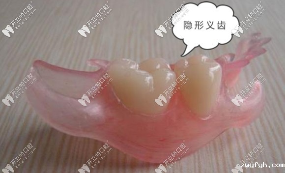 就想知道隐形义齿是否可以长期佩戴?包括晚上也不摘下来