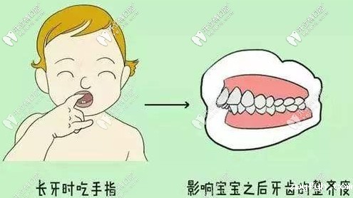 不良习惯会导致矫正反弹