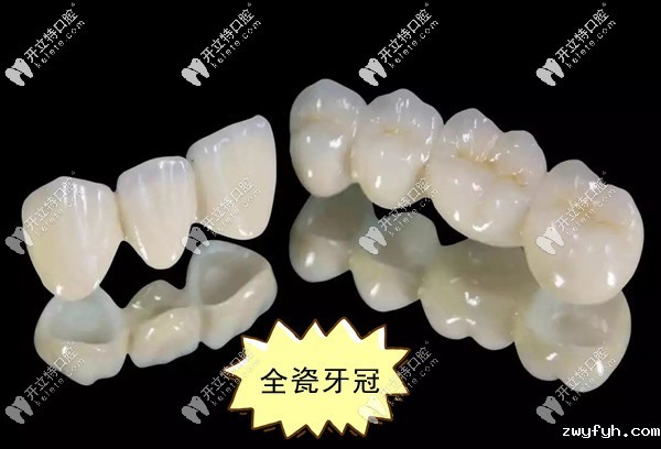 一文解百惑!瑞典procera与美国LAVA全瓷牙的区别你知多少?
