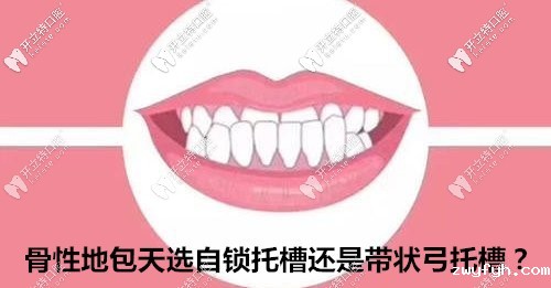据说骨性地包天用全同步带状弓矫正比戴自锁牙套好?真or假
