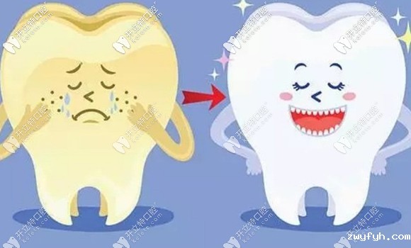 牙齿很黄怎么都刷不白?不如试试我做的这个beyond冷光美白吧