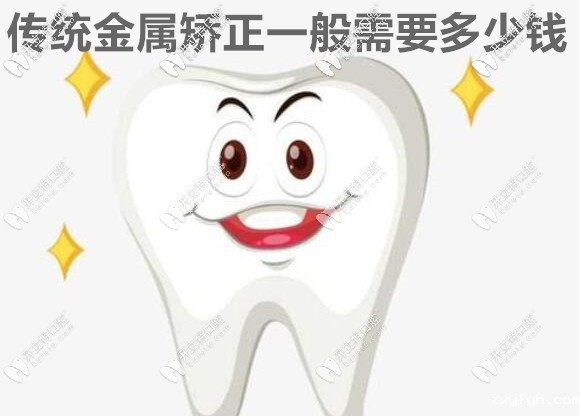 我知道传统金属钢托矫正需要多少钱,它比隐形的价格还划算