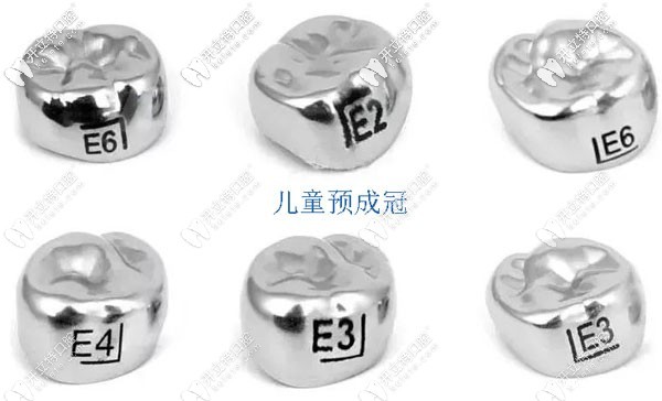 儿童预成冠示意图
