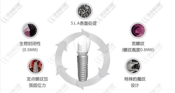 上海曙康口腔种植牙价格表公布,来看曙康种植牙多少钱一颗?